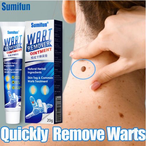 Wart Care Cream – Skin Smoothing Cream for Common Warts & Corns