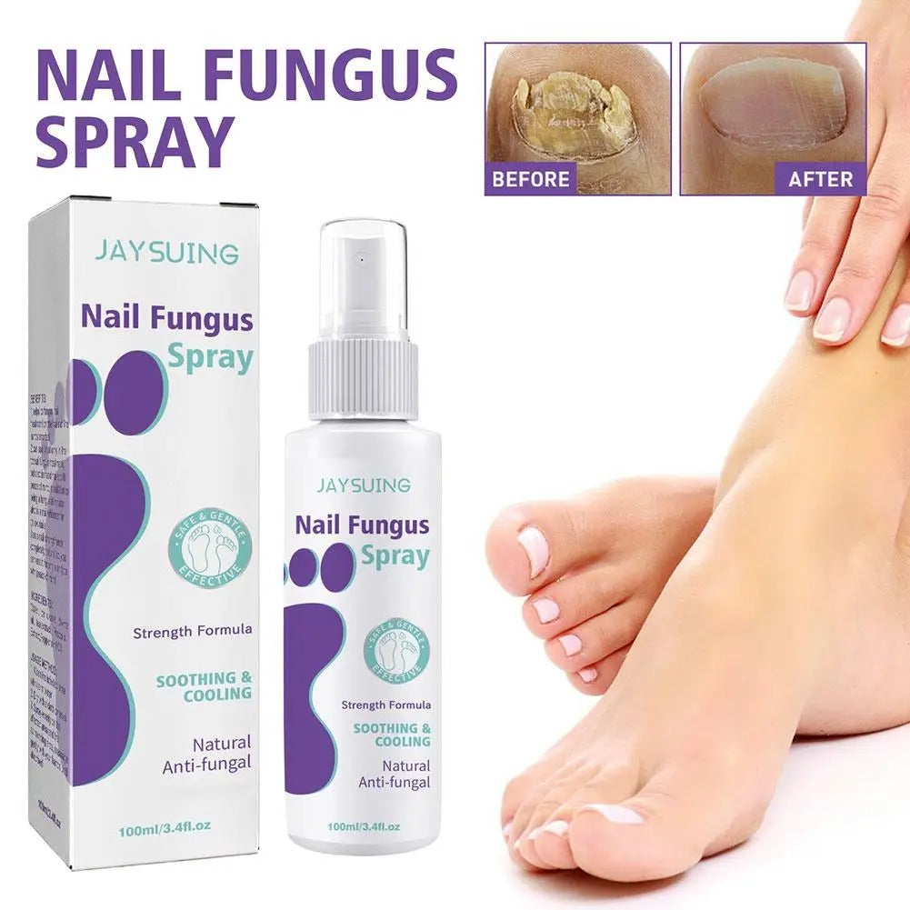 Nail Fungus Spray
