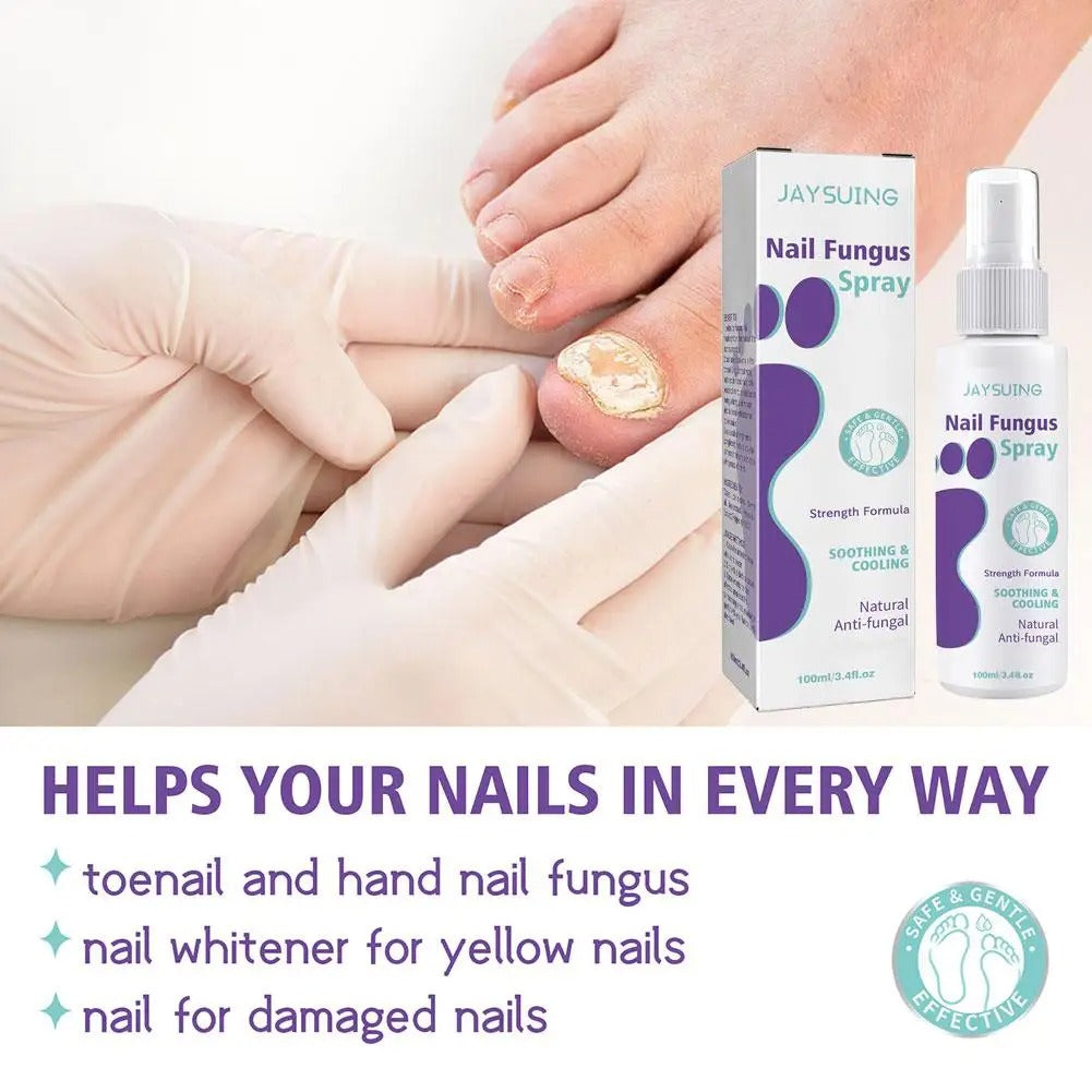Nail Fungus Spray